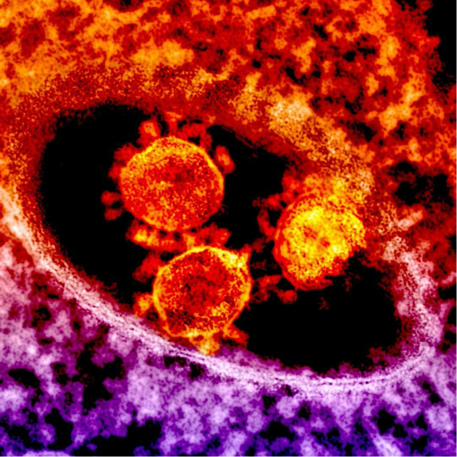 coronavirus - amitiel consultants blog